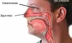 Жжение в одной ноздре