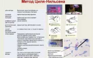 Окраска по цилю нильсену методика